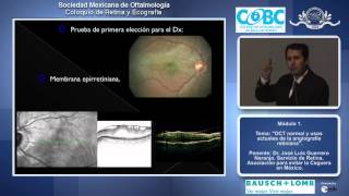 OCT normal y usos actuales de la angiografía retiniana  Dr José Luis Guerrero Naranjo [upl. by Lesnah621]