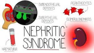 Nephritic Syndrome  Causes  Symptoms  Types  Treatment [upl. by Adiela]