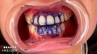 Purple Teeth Stains Can Temporarily Brighten Yellow Stains  Beauty Insider [upl. by Ahsenauq]