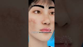 Melasma Why Do These Dark Spots Appear on Your Skin shorts darkspots  Creativelearning3d [upl. by Labors]