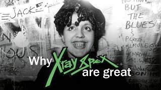 Why XRAY SPEX are great [upl. by Rahm]