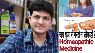 Warts  Effective Homeopathic Medicine  When Thuja Not effective On Warts  What to do [upl. by Natye576]