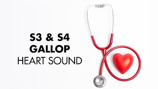 S3 and S4 Gallop  Heart Sounds  MEDZCOOL [upl. by Anhej]