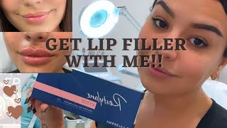 Restylane Kysse Lip Filler Vlog  Sylvia Ruback [upl. by Ytinav]