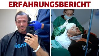 Meine HaartransplantationHaarverdichtung in Istanbul Erfahrungsbericht [upl. by Fari]