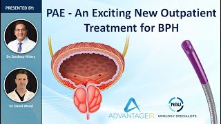 PAE A New Treatment For BPHWebinar [upl. by Emmuela]