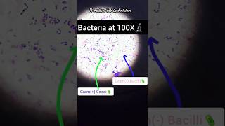 Gram positive amp Gram positive bacteria  Gram stain  bacteria shorts viralshorts lab bacteria [upl. by Shaffer]