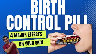 4 MAJOR Effects of Birth Contrl Pills On Your Skin [upl. by Barnie474]