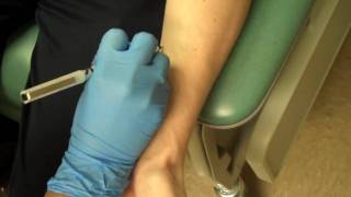 Allergy Testing Step 1 Skin Prick Testing [upl. by Etnom]