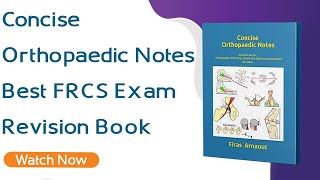 Concise Orthopaedic Notes  Best FRCS Ortho Revision Book  Orthopaedic Academy [upl. by Nesto]