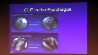 What is Barretts Esophagus  Dr Raman Muthusamy [upl. by Marrin288]