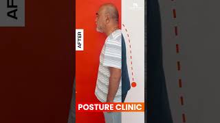 How to Improve your Posture Mission Health Posture Clinic  Kyphosis  Scoliosis  Flat Back [upl. by Kcirrag70]