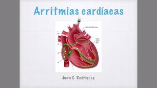 Arritmias cardíacas en el EKG [upl. by Elder]