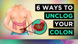 6 Ways To CLEAR Your CONSTIPATION [upl. by Areema]