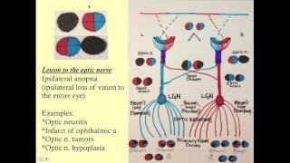 Neuroopthalmology  CRASH Medical Review Series [upl. by Adilem]