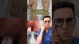 Señales de que tu corazón se está enfermando medicina shorts [upl. by Nibor]