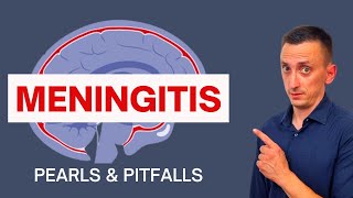 BACTERIAL MENINGITIS IN ADULTS SYMPTOMS CAUSES DIAGNOSIS AND TREATMENT [upl. by Delastre334]