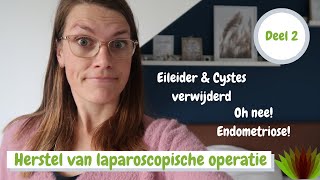 Eierstok cystes  eileider verwijderd amp ENDOMETRIOSE 😱 Mijn ervaringsverhaal [upl. by Lyford]