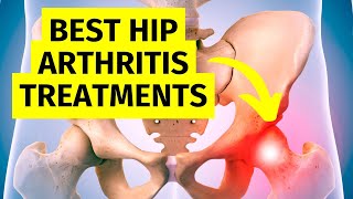 The Best Hip Arthritis Treatments Without Surgery [upl. by Calica]