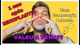 1 ANO APÃ“S RINOPLASTIA O QUE MUDOU VALE A PENA DICAS CUIDADOS [upl. by Arv]