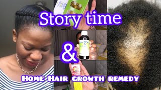 Storytime suffering from alopeciahome hair growth remedy My hair loss journey injury headaches [upl. by Joab]