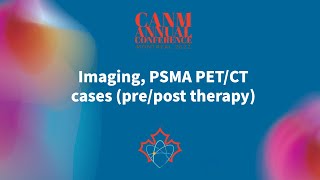 Imaging PSMA PETCT cases prepost therapy [upl. by Aber]