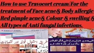 How to use Travocort creamFor the treatment of Face acneampBody allergic Red pimples acne reactions [upl. by Anila571]