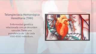 THH Telangiectasia Hemorrágica Hereditaria  Diagnóstico Genético  Secugen [upl. by Aerehs]