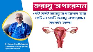 Laparoscopic Hysterectomy Vs Abdominal Hysterectomy Dr Sankar Dasmahapatra Gynaecologist in kolkata [upl. by Godber]