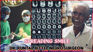 Spreading Smile  Chronic Subdural Hematoma  SDH  Complete Recovery  NEET UG  NEET PG  NEET SS [upl. by Lois]