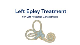 At Home Left Epley Maneuver for BPPV Vertigo [upl. by Sirama]