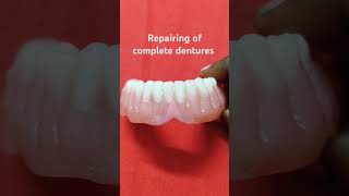 Repairing of dentures do anyone interested in collaboration do comment oralrehabilitation [upl. by Phineas]