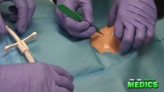 Surgical Cricothyrotomy by the Paramedic Intern [upl. by Aisatan]