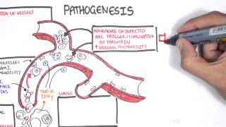 Malaria Pathophysiology [upl. by Truc]