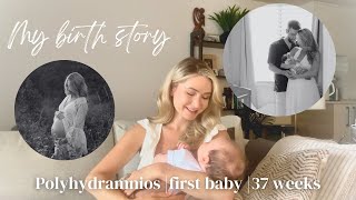 My Birth Story  Positive Birth at 37 Weeks  Polyhydramnios  Vacuum Assisted [upl. by Tuneberg]