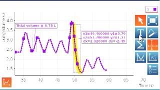 Spirometer Part 2 [upl. by Deborath]