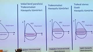 sft solunumfonksiyontesti isg işyerihekimi [upl. by Chilton354]