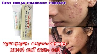 Azelaic Acid Cream 10 Review Malayalam  Best indian pharmacy product for pimples and Dark Spot [upl. by Latnahc228]