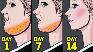 FACE WORKOUT TO LOSE FACE FAT  6DAY CHALLENGE [upl. by Winograd]