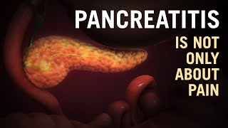 Pancreatitis  Is it a killer disease Dr Purnendu Roy explains  MS FICS FAISDUROLLON [upl. by Gualtiero976]