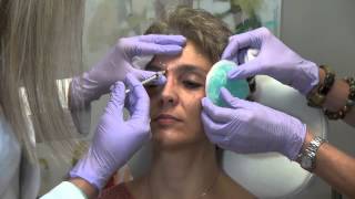 What is Botox and How Does it Work [upl. by Abey]