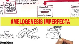 Amelogenesis Imperfecta  Pathogenesis Types Clinical features and Treatment [upl. by Wallace]