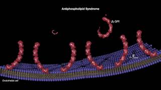 Antiphospholipid syndrome [upl. by Rustin]