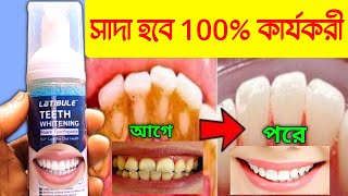 পান খইনি তেরেঙ্গা গুটকার দাঁত ঝকমক করবে  Latibule Teeth Whitening Foam Toothpaste [upl. by Sellma622]