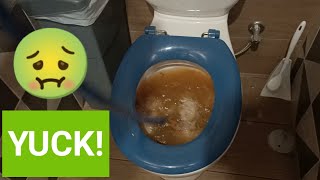 Blocked Drain 14  DISGUSTING Blocked Toilet  How to UNCLOG a Toilet [upl. by Trumann]