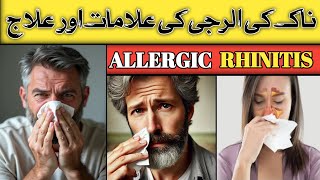 ALLERGIC Rhinitis And Its Treatment  Naak Ki Allergy Ka Ilaj  DrKashif Bilal [upl. by Nobell]