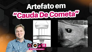 ARTEFATO EM “CAUDA DE COMETA” APRENDA O QUE É E COMO SURGE I VOCÊ RADIOLOGISTA [upl. by Odnolor]