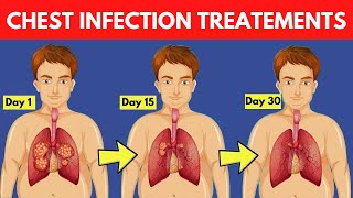 10 Natural Chest Infection Treatments Home Remedies You Need to Try Now [upl. by Nottus]