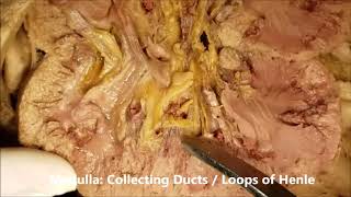 RENAL CORTEX MEDULLA CALICES and CARBUNCLE Dissection by MD Students  Sanjoy Sanyal [upl. by Collins130]