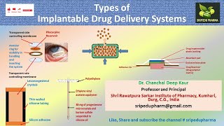 Types of Implantable Drug Delivery Systems [upl. by Sivrup]